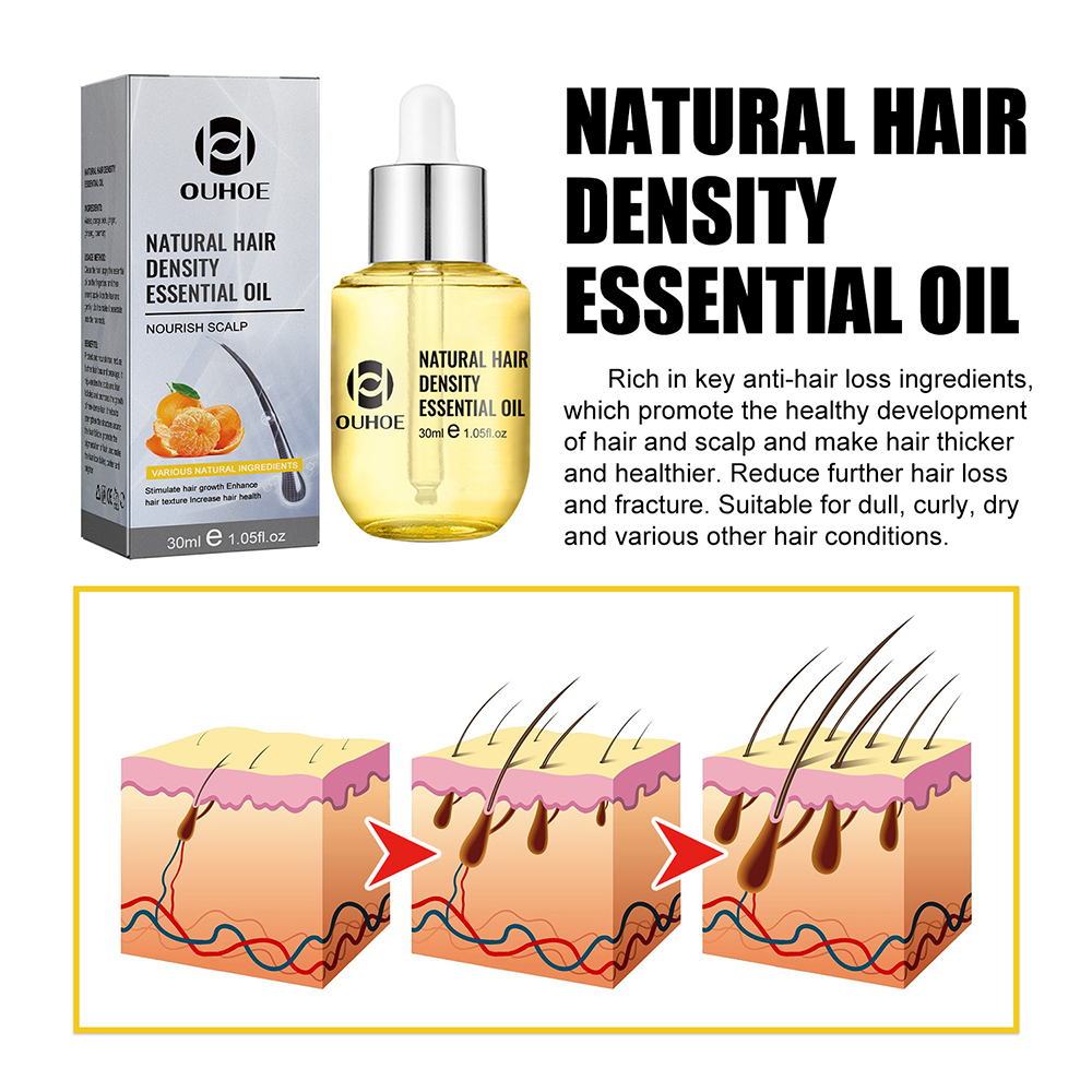1/2PCS Ginger Hair Growth Oil  – Hair Care Ginseng Bewertung und Preis