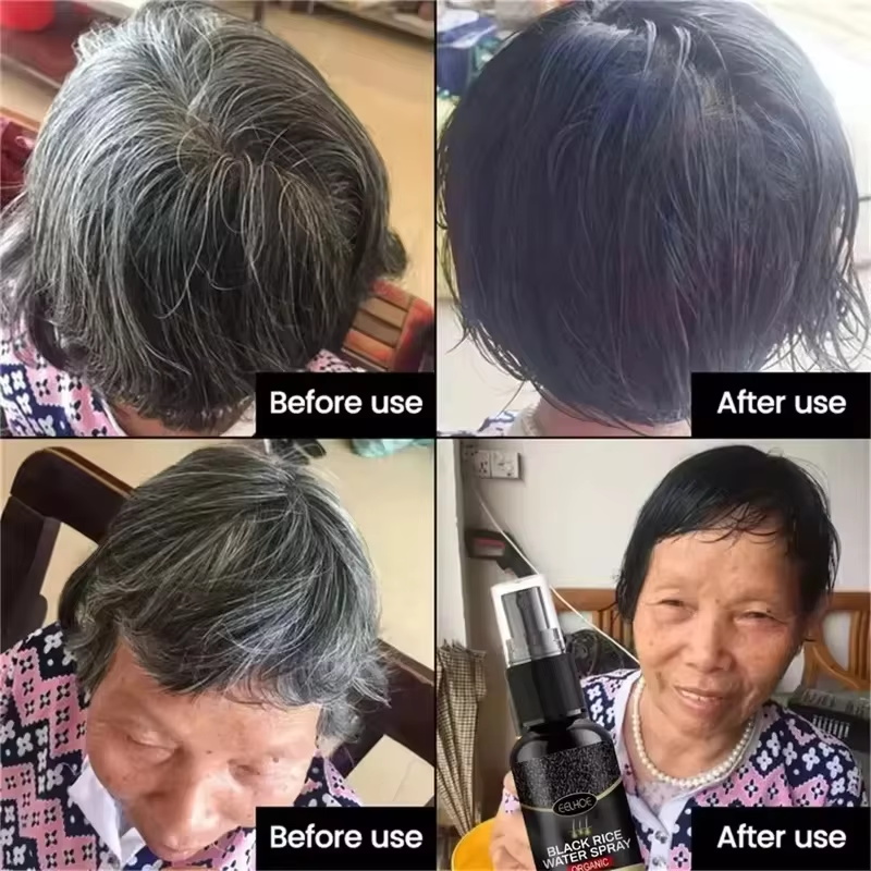 Gray White Hair Treatment Seru – Hair Care Ginseng Bewertung und Preis
