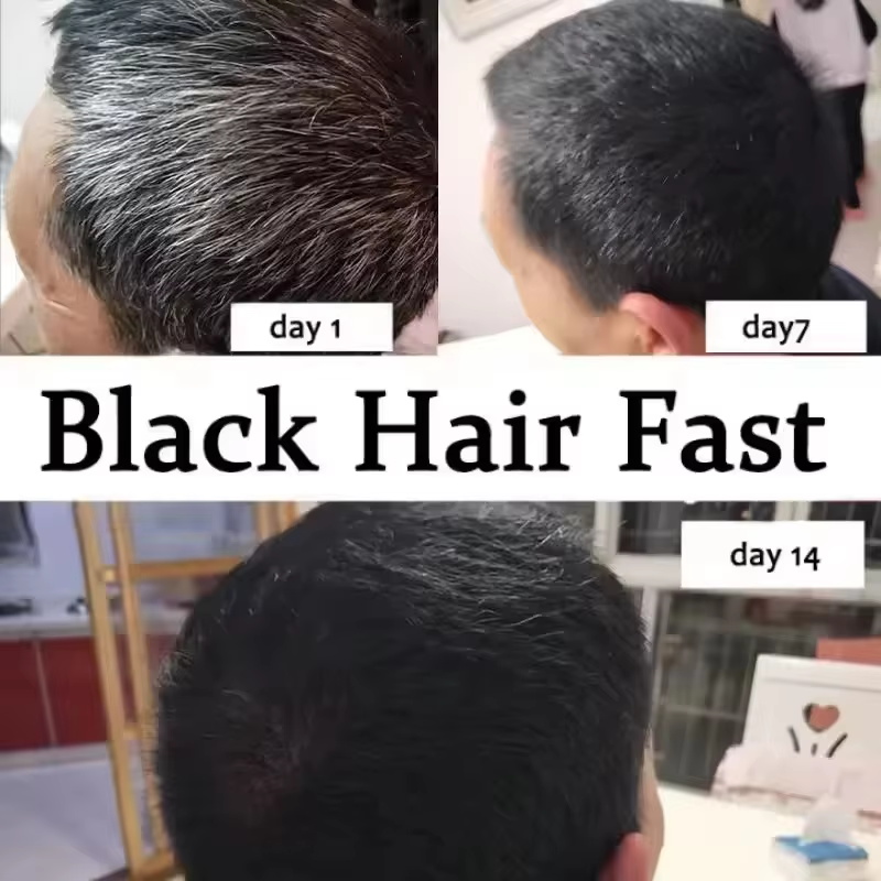 Gray White Hair Treatment Seru – Hair Care Ginseng Bewertung und Preis