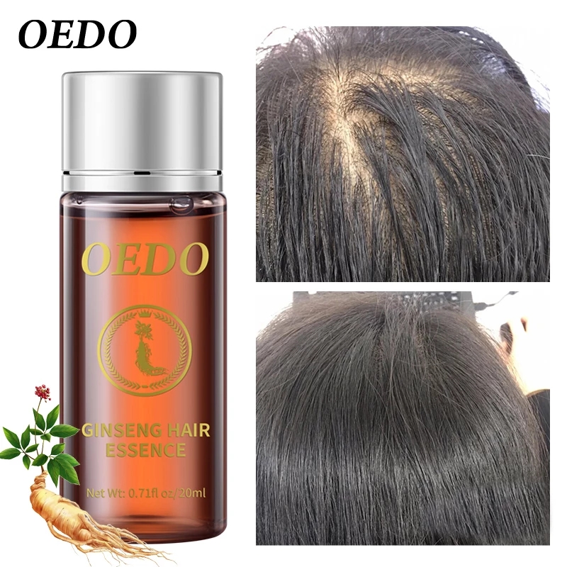 20ML Ginseng Hair Growth Essen – Hair Care Ginseng Bewertung und Preis