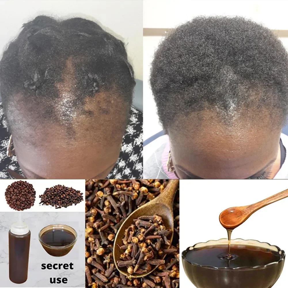 Africa Women Traction Alopecia – Hair Care Ginseng Bewertung und Preis