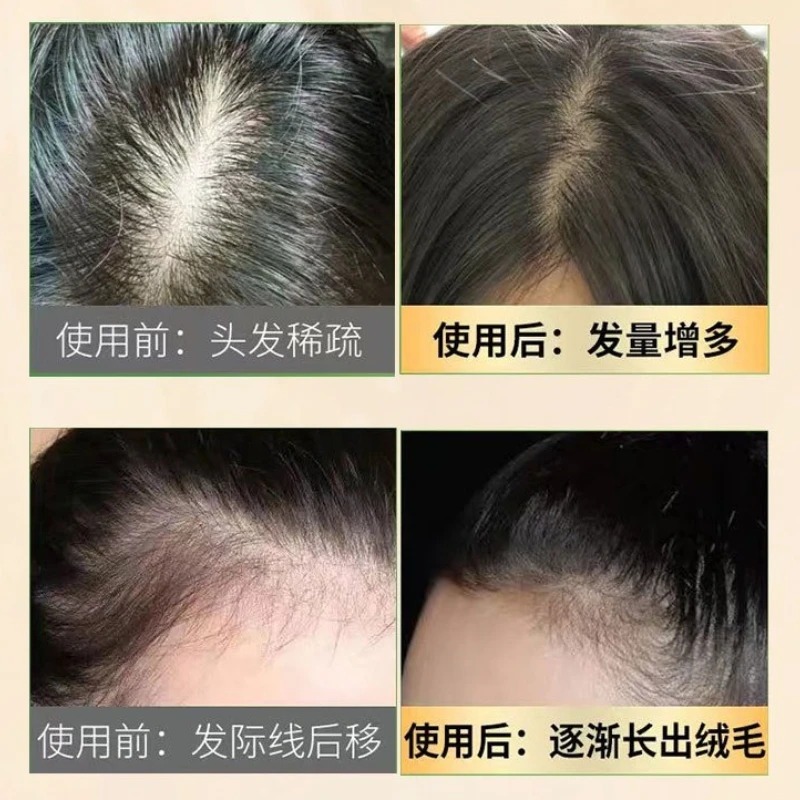 Natural Ginseng Hair Loss Care – Hair Care Ginseng Bewertung und Preis