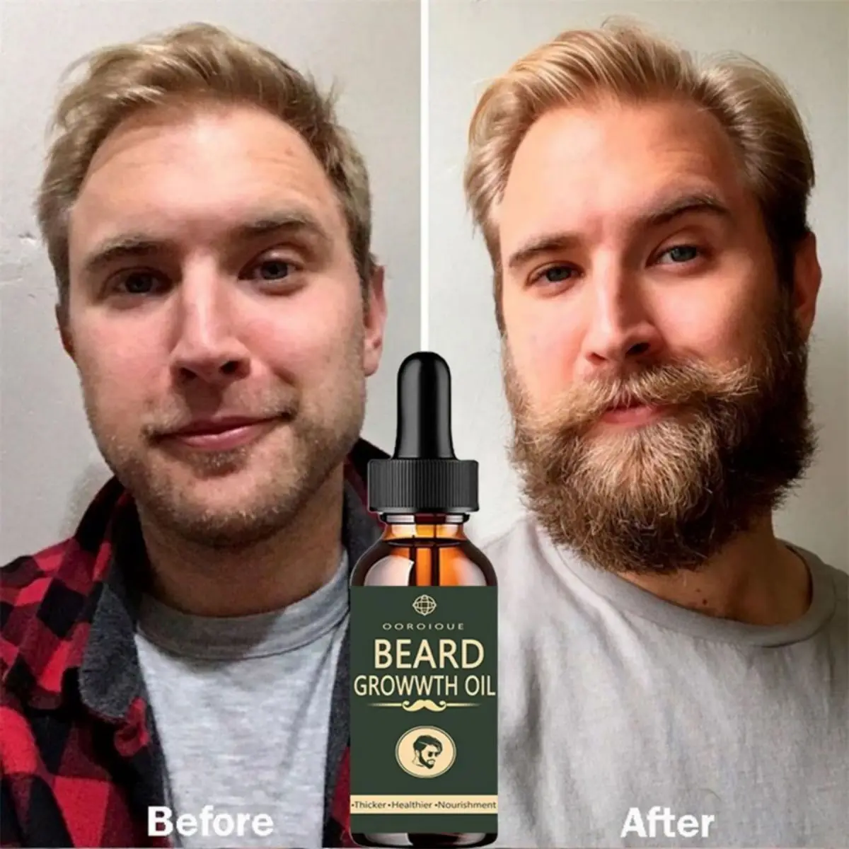 Fast Beard Growth Oil Beard Oi – Hair Care Essence Oil Spray Bewertung und Preis