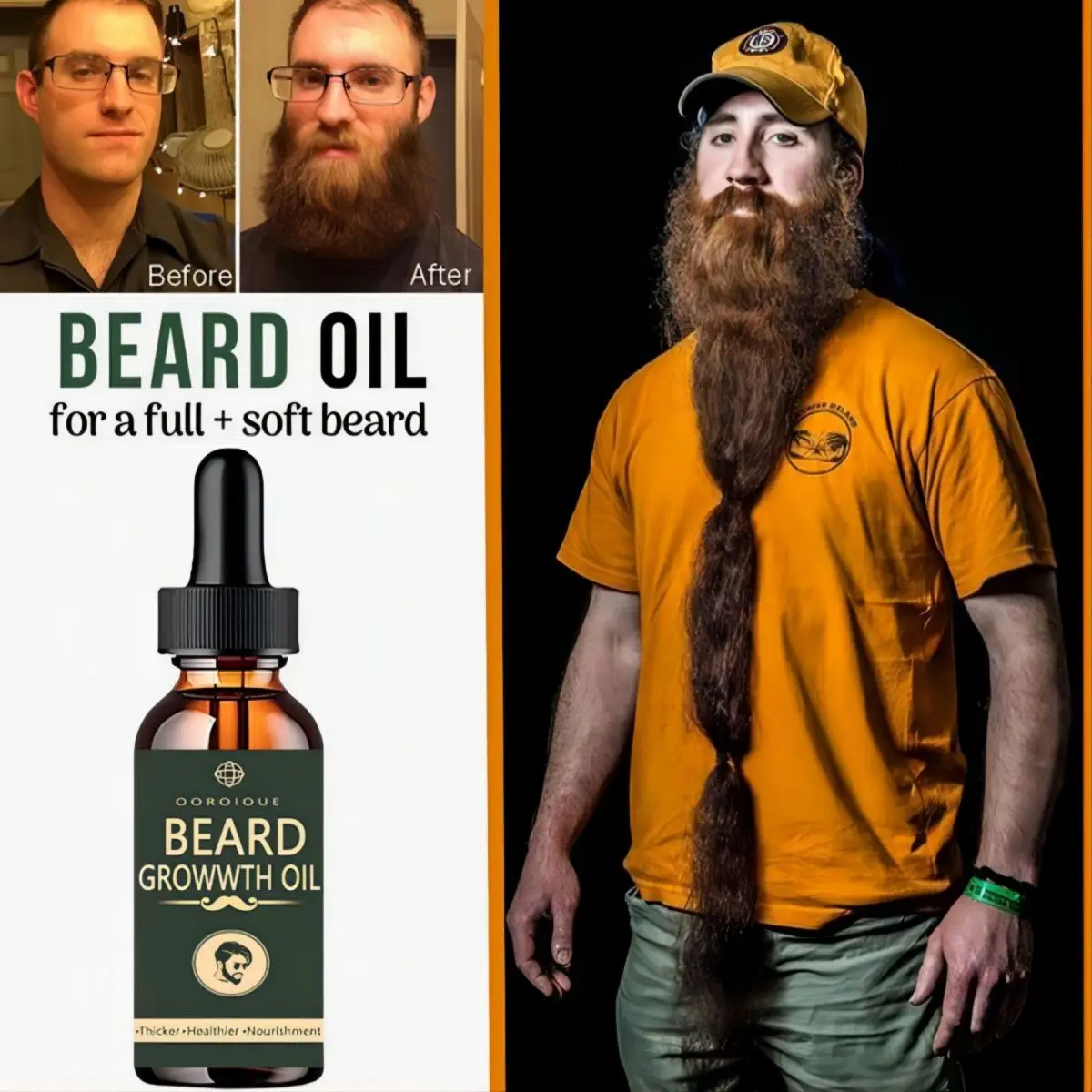 Fast Beard Growth Oil Beard Oi – Hair Care Essence Oil Spray Bewertung und Preis