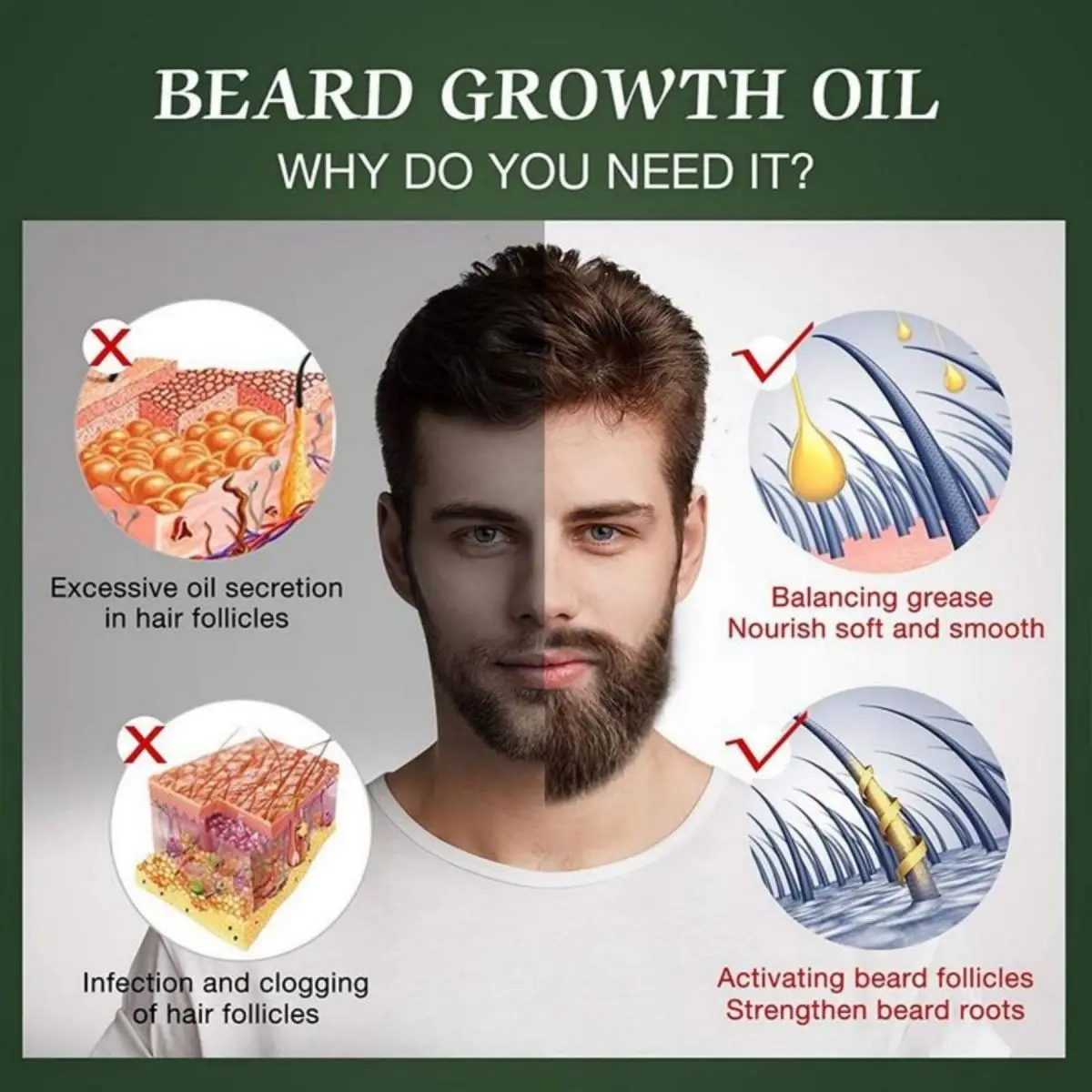 Fast Beard Growth Oil Beard Oi – Hair Care Essence Oil Spray Bewertung und Preis