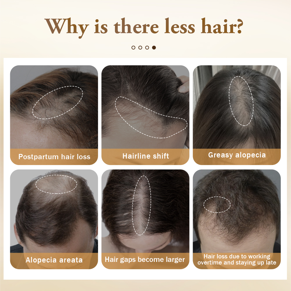 PURC Hair Growth Products for  – Hair Care Ginseng Bewertung und Preis
