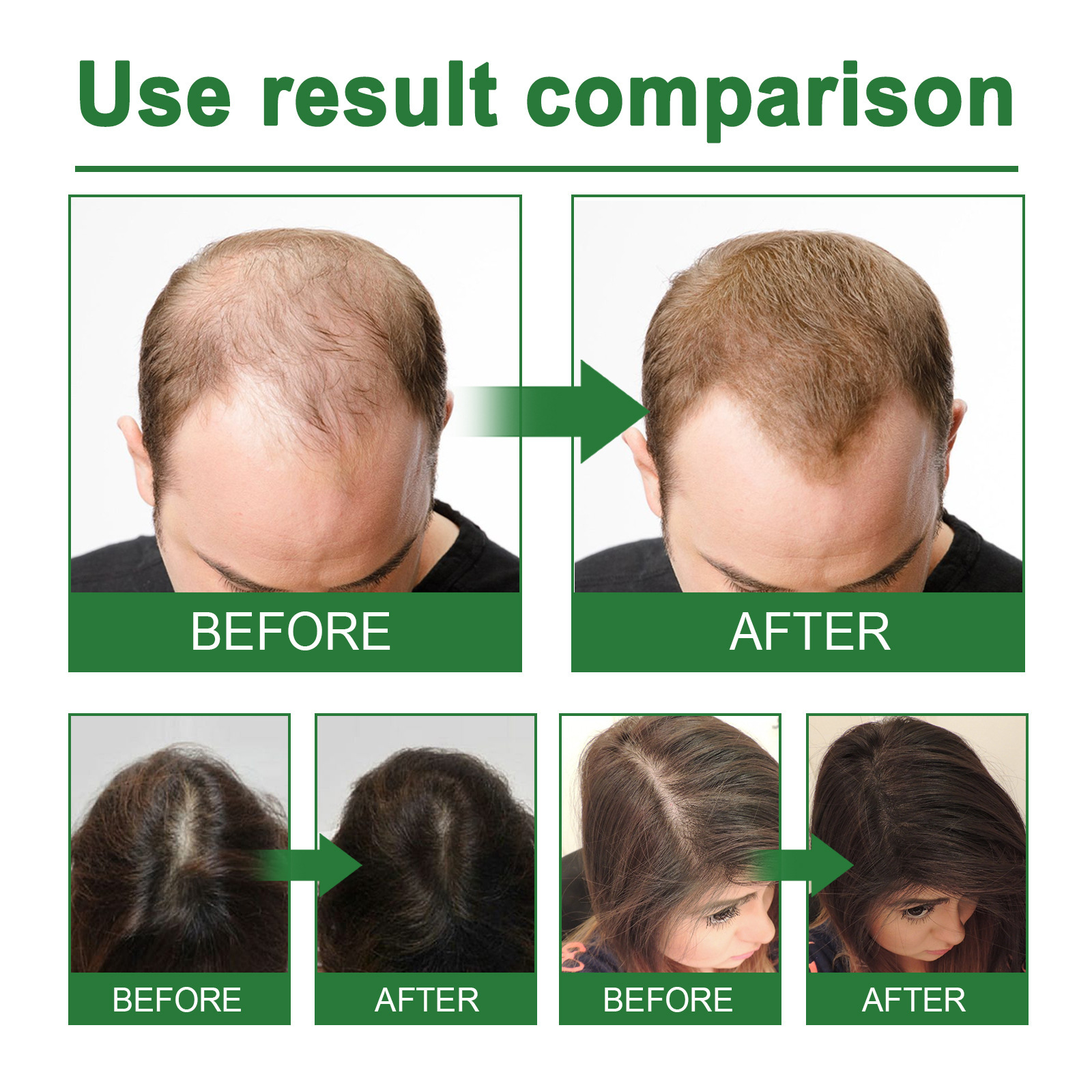 Rosemary Spray for Hair Nouris – Hair Care Nature Bewertung und Preis