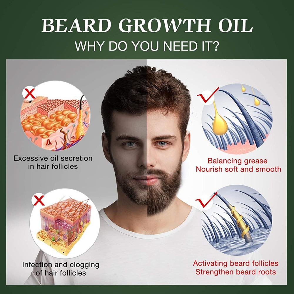 Fast Beard Growth Oil Beard Oi – Hair Care Essence Oil Spray Bewertung und Preis