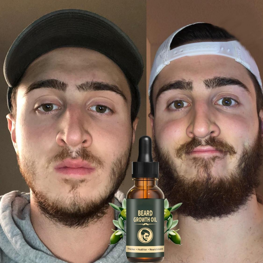 Fast Beard Growth Oil Beard Oi – Hair Care Essence Oil Spray Bewertung und Preis