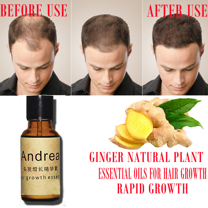 2/5/10Pcs Andrea Hair Growth S – Hair Care Essence Oil Spray Bewertung und Preis