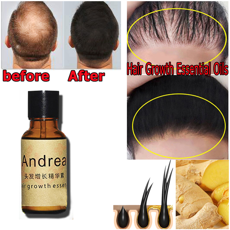 2/5/10Pcs Andrea Hair Growth S – Hair Care Essence Oil Spray Bewertung und Preis